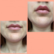 247fc21e-035c-4803-8e84-2d6ce3717be5