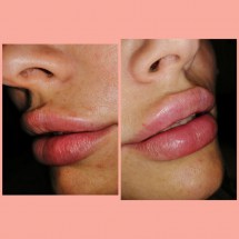 c57e6f56-c91a-4375-9c13-e57caa0ad2b2